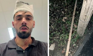 batut timisoara foto ziua de vest jpg