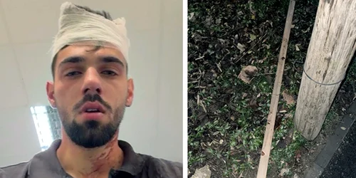 batut timisoara foto ziua de vest jpg