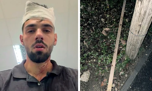 batut timisoara foto ziua de vest jpg