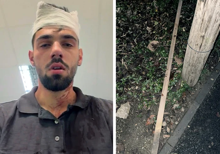 Adolescentul a fost lovit cu un par în cap. FOTO: ziuadevest