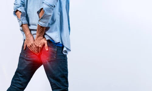 boala hemoroidala jpg