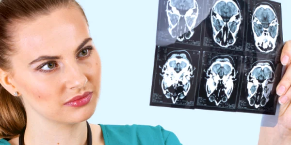 Computerul tomograf depistează tumorile cerebrale