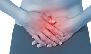 1 endometrioza 700x366 jpg jpeg