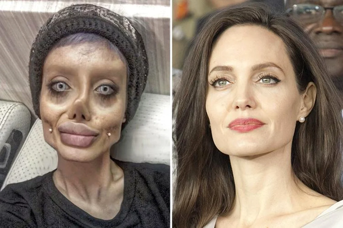Sarah Tabar a ajuns în atenţia presei după ce a publicat o fotografie în care apărea desfigurată, păcălind internauţii că a făcut operaţii estetice pentru a arăta ca Angelina Jolie