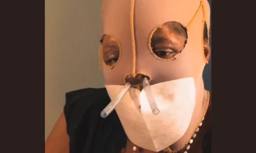 María Consuelo Córdoba a fost atacata cu acid in 2000 png