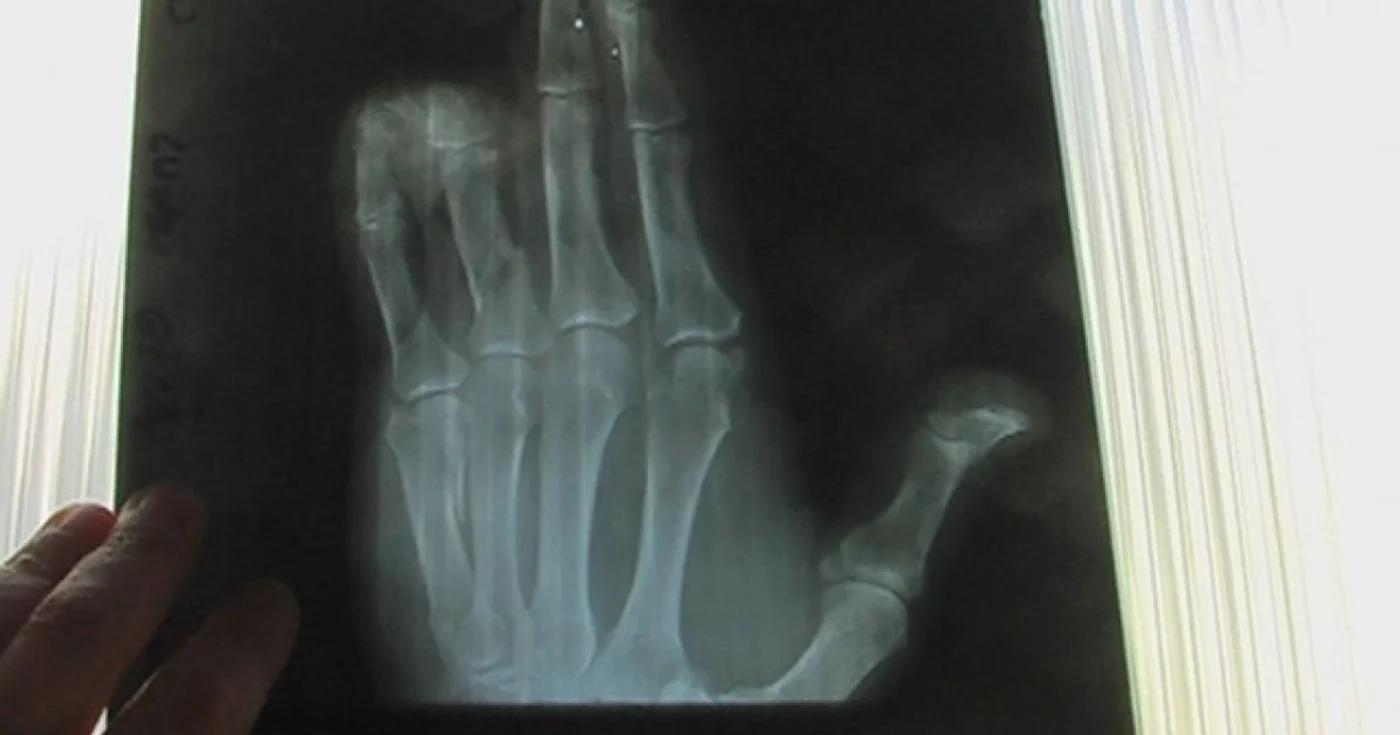 Radiografie