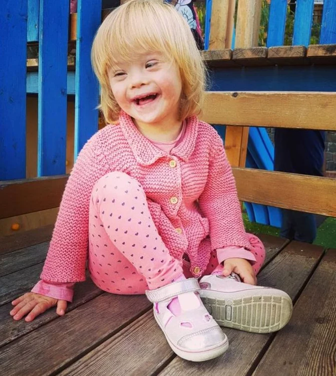 Alba are sindromul Down