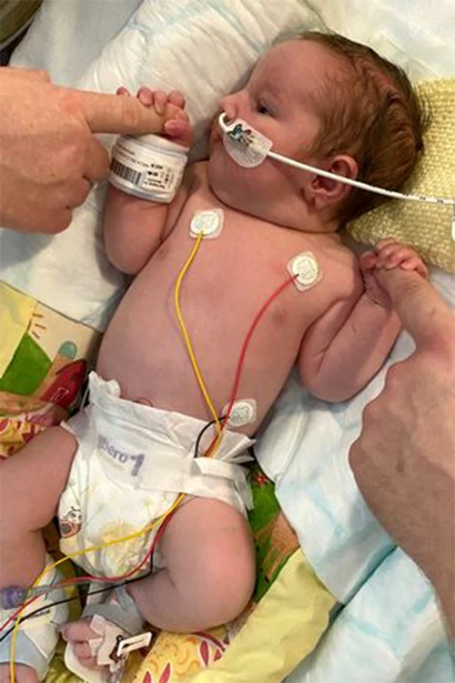 Bebeluşul a fost hrănit multă vreme printr-un tub. Foto: Arhivă personală