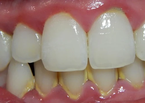 1 66173 original jpg jpeg