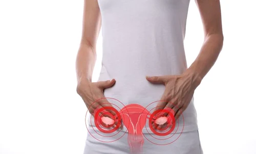 1 ovare polichistice jpg jpeg