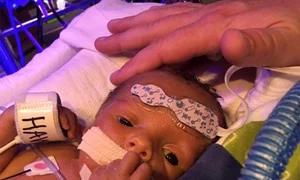 Hawk s a născut cu o boală gravă (foto: Facebook) jpeg