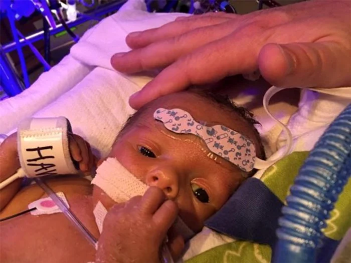 Hawk s-a născut cu o boală gravă (foto: Facebook)