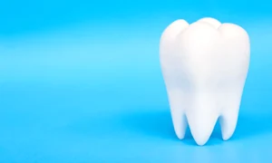 Implant dentar premium   Ce tipuri de implant dentar exista  jpg