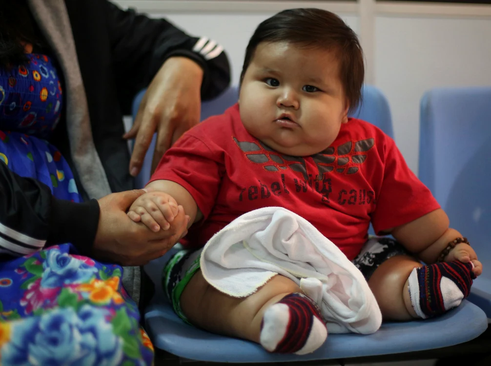 
    Micuţul va ţine dietă, iar apoi va fi supus unor operaţii (foto: reuters)  