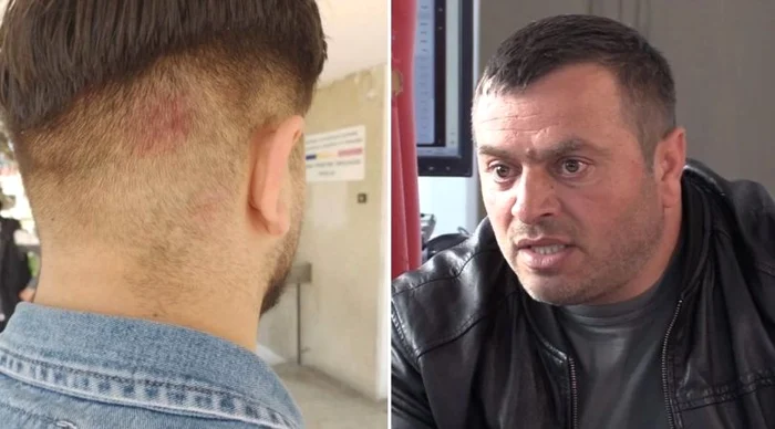 Adolescentul rănit și tatăl său FOTO stiriest.ro