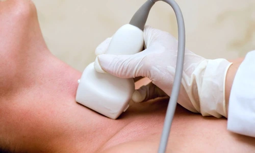 1 74795 original jpg jpeg