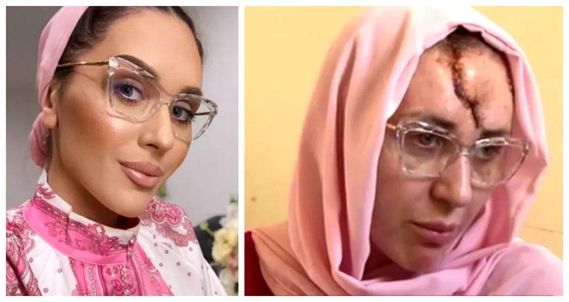 Dana Roba, măcelărită de propriul soț. Sursă: Click!
