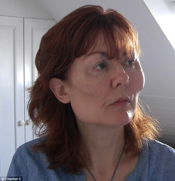 După ce implanturile i-au căzut, ea şi-a făcut injecţii care i-au deformat chipul