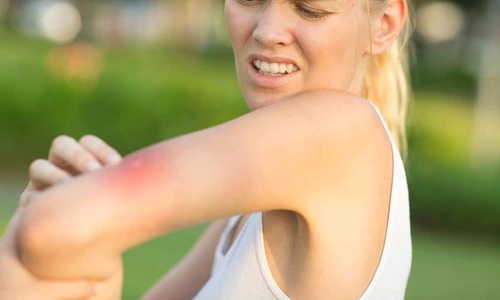 1 muscatura de tantar 1 jpg jpeg