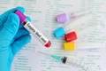 bloodshutterstock 342696227 jpg
