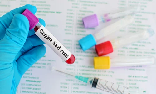bloodshutterstock 342696227 jpg