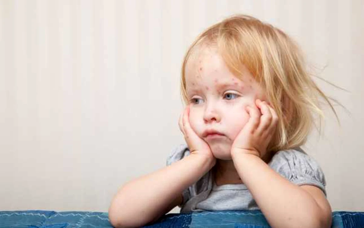 Prin multe boli contagioase putem trece fără uşor, altele, însă, se pot complica mortal FOTO: Shutterstock