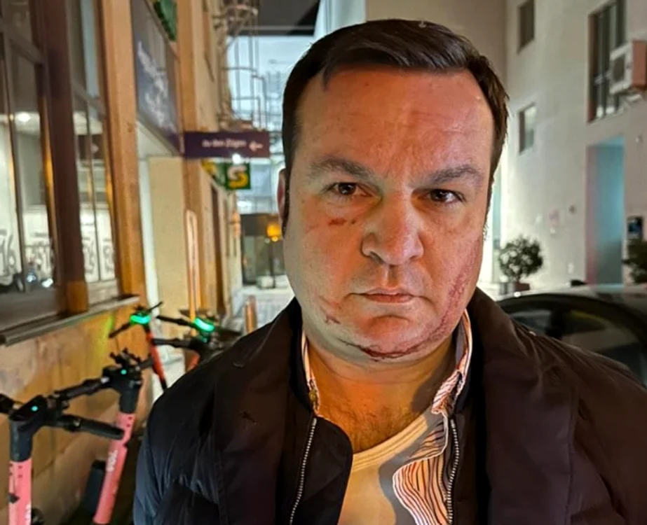 Oamenii se întreabă dacă zgârieturile de pe fața primarului sunt reale