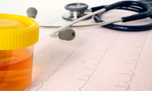 acid uric crescut jpeg