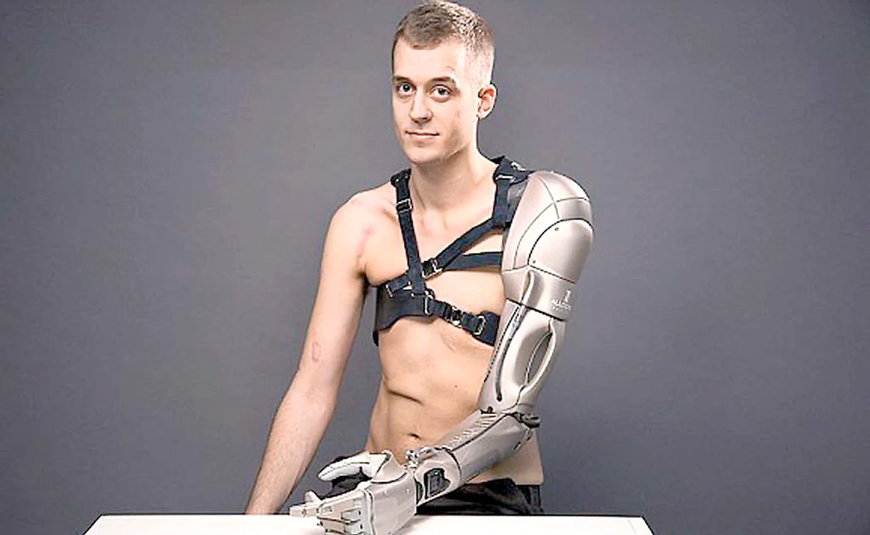 
    James,  mândru că e jumătate robot  