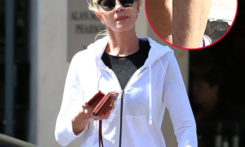 Exclusive Melanie Griffith Visits A Doctor For A Rash jpeg