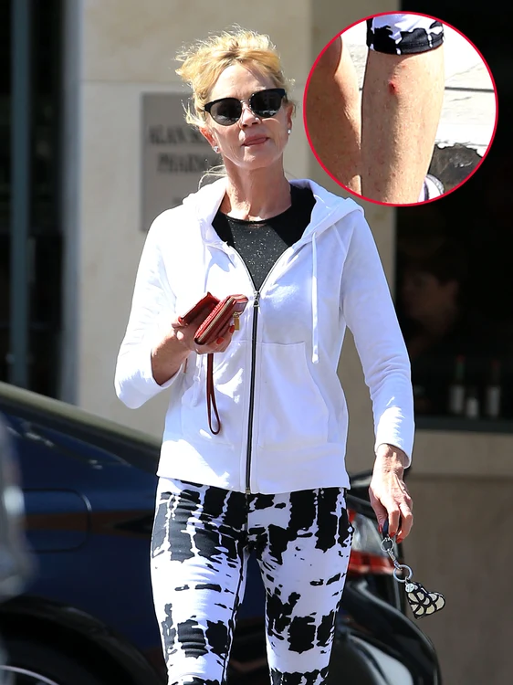 Exclusive    Melanie Griffith Visits A Doctor For A Rash jpeg