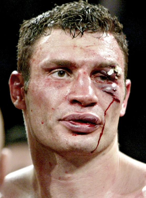 Klitschko