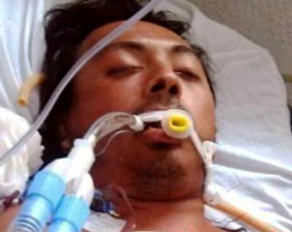 
    Bărbatul a murit la spital la opt zile după incidentfoto: metro.co.uk  