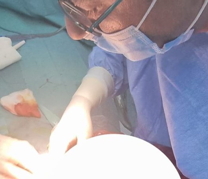 Un copil a ajuns la spital cu stare de rău și vărsături. Medicii arădeni i-au extirpat o tumoră de trei kilograme