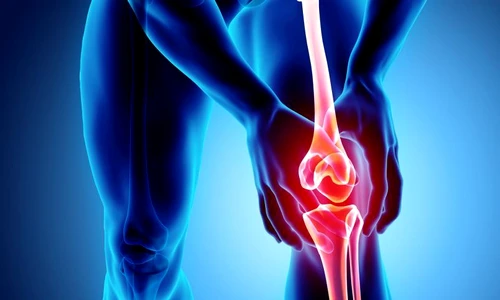 1 test artroza jpg jpeg