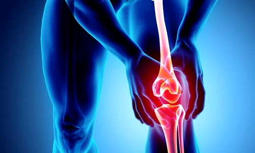 1 test artroza jpg jpeg