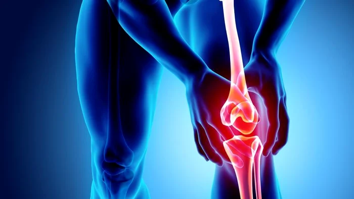 1 test artroza jpg jpeg