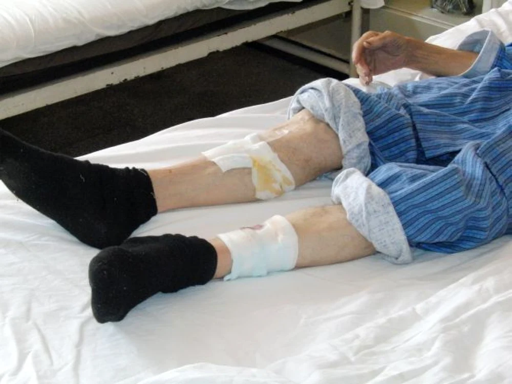 Bătrânul a ajuns în stare gravă la spital după ce a fost muşcat de trei câini de luptă