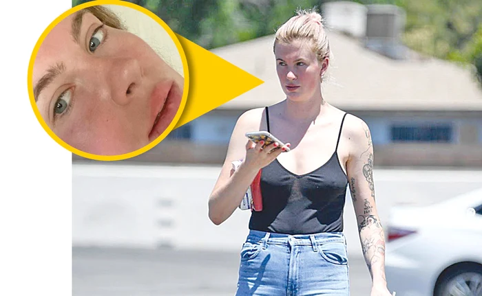 Ireland Baldwin, 24 de ani, a sunat poliţia imediat după ce a fost atacată