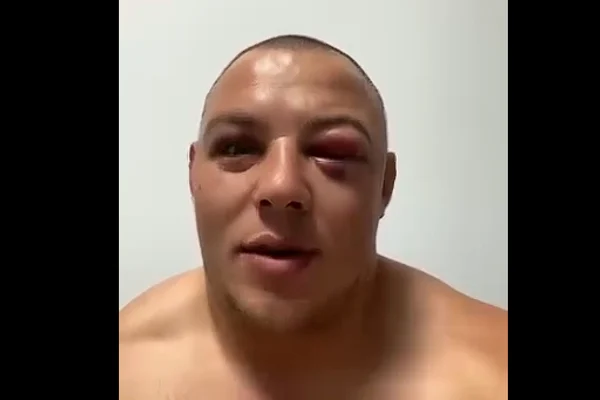 Danu Spartanu, după bătaia cu Tolea Ciumac: „Mă doare capul. Până la nuntă, trece”. Ce i-a spus Marian Ceaușescu luptătorului MMA 