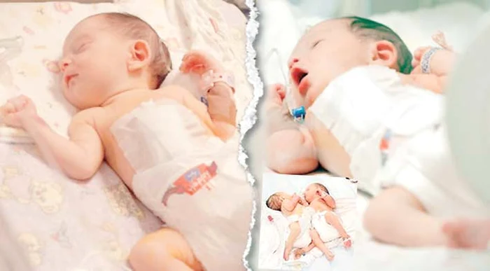 
    Înainte de operaţieFoto: Spitalul „Marie Curie”  