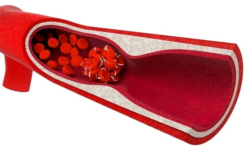 1 shutterstock 376055884 jpg jpeg