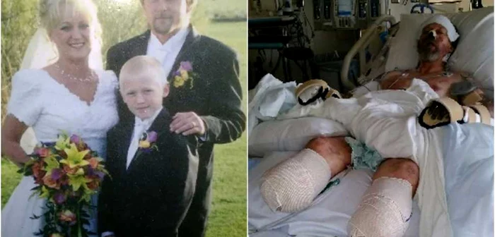 Stânga: Greg alături de soţie şi copil / Dreapta: Greg în spital, înainte de operaţie de amputare a mâinilor FOTO USA Today