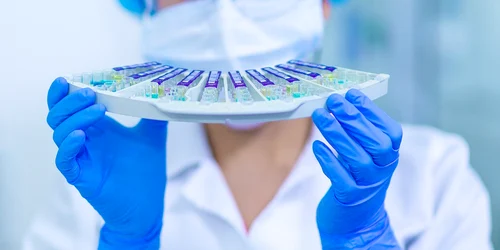 laborator grupa de sange probe FOTO: Pixabay