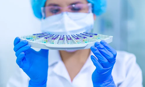 laborator grupa de sange probe FOTO: Pixabay