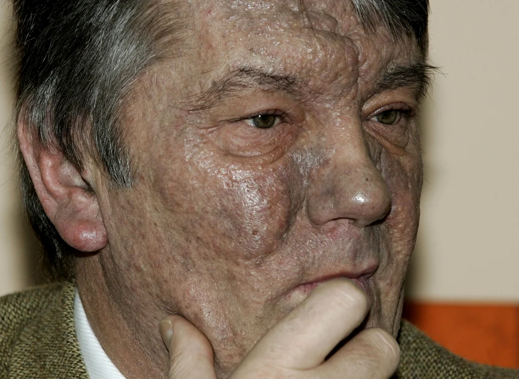 Viktor Iușcenko