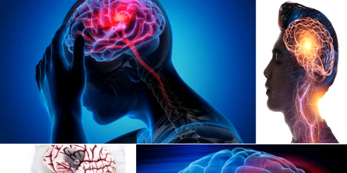 Atacul cerebral vascular reprezintă una dintre principalele cauze de deces în România Colaj DMS