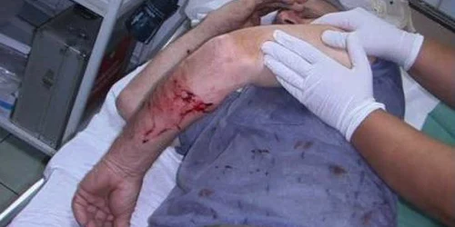 Bărbatul a primit îngrijirile necesare la UPU