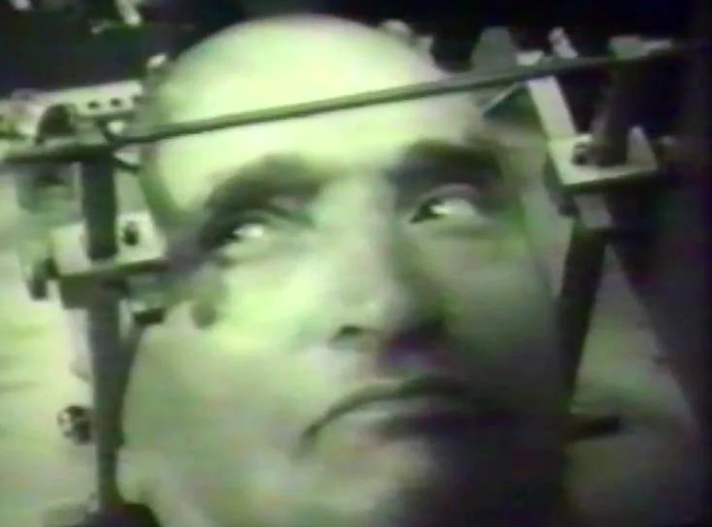 Operaţie pe creier la Timişoara, în anul 1973