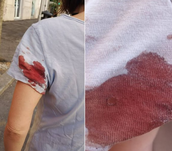 Atac armat pe o stradă din Roma. O jurnalistă a fost împușcată de un individ care ar viza femeile